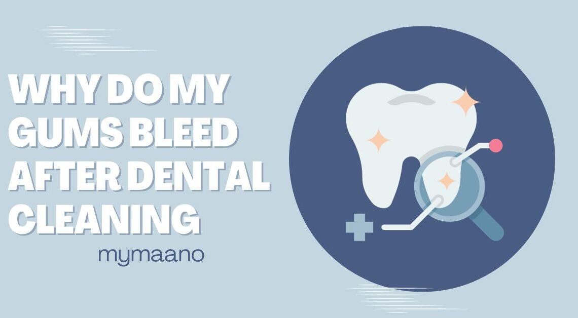 WHY DO MY GUMS BLEED AFTER DENTAL CLEANING