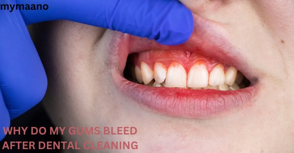 WHY-DO-MY-GUMS-BLEED-AFTER-DENTAL-CLEANING-2