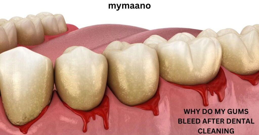 WHY-DO-MY-GUMS-BLEED-AFTER-DENTAL-CLEANING-3